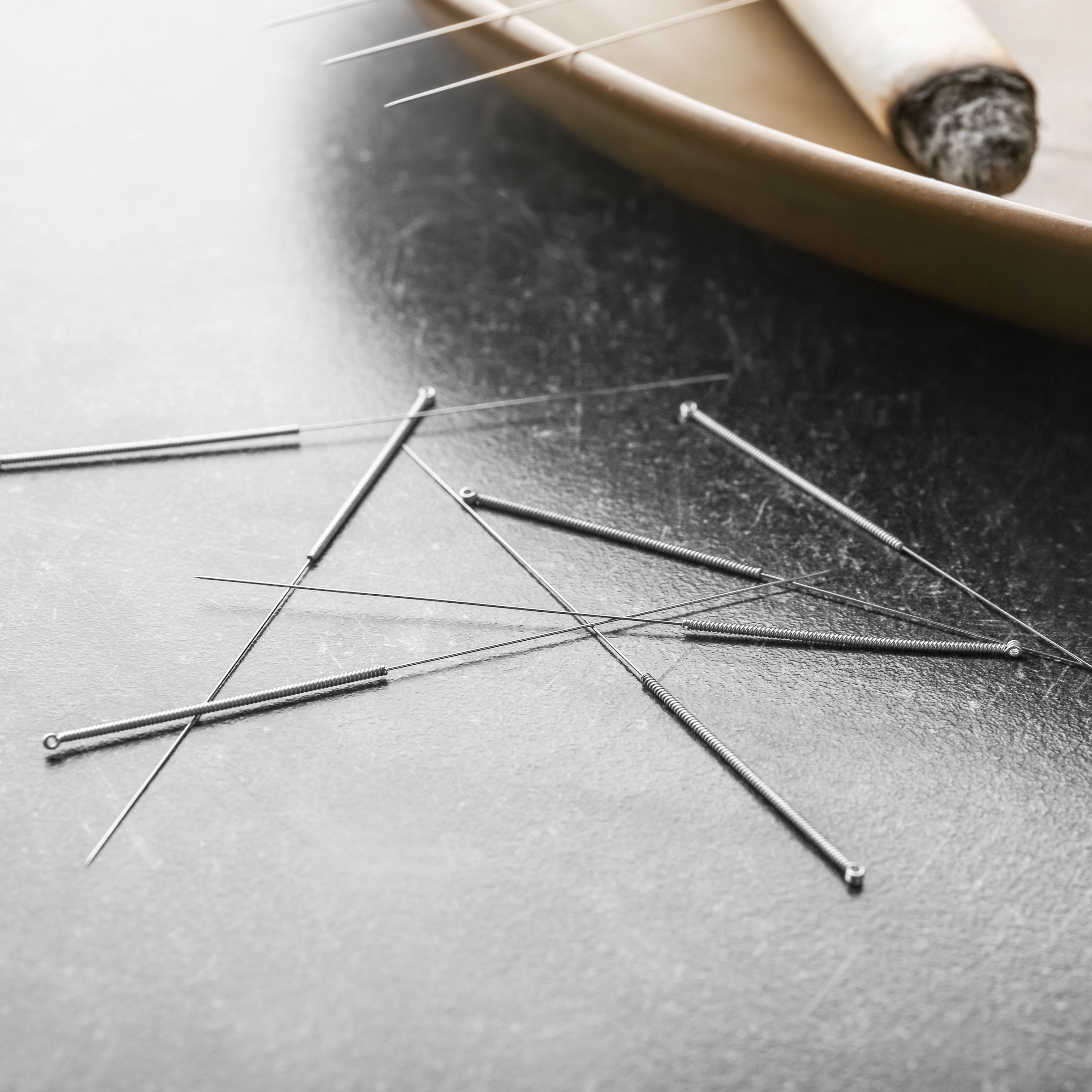 Das Dry Needling ist eine Methode, die immer in Kombination mit manuellen Techniken angewendet wird. Im Dry Needling arbeitet man mit Akupunkturnadeln, hat aber ansonsten nichts mit der Akupunktur gemeinsam. Mit der Nadel erreicht man punktgenau die myofaszialen Triggerpunkte, die für den beklagten Schmerz ursächlich sind. So kann das trockene Nadeln eine wirksame Ergänzung bei akuten und chronischen Schmerzen sein. 