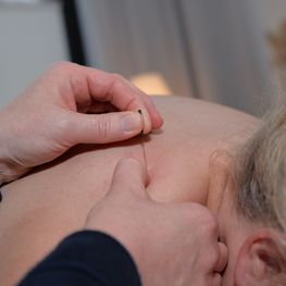 Die Traditionelle chinesische Medizin (TCM) geht davon aus, dass die meisten Erkrankungen auf einen gestörten Energiefluss zurückzuführen sind. D. h. Schmerzen werden hervorgerufen durch einen Stau im Fluss der Lebensenergie des Qi und/oder des Blutes, welcher durch die Akupunktur gelöst und harmonisiert werden kann. Die Akupunktur wird in der Regel als wohltuend, entspannend und als oft verblüffend schnell wirksam empfunden. 